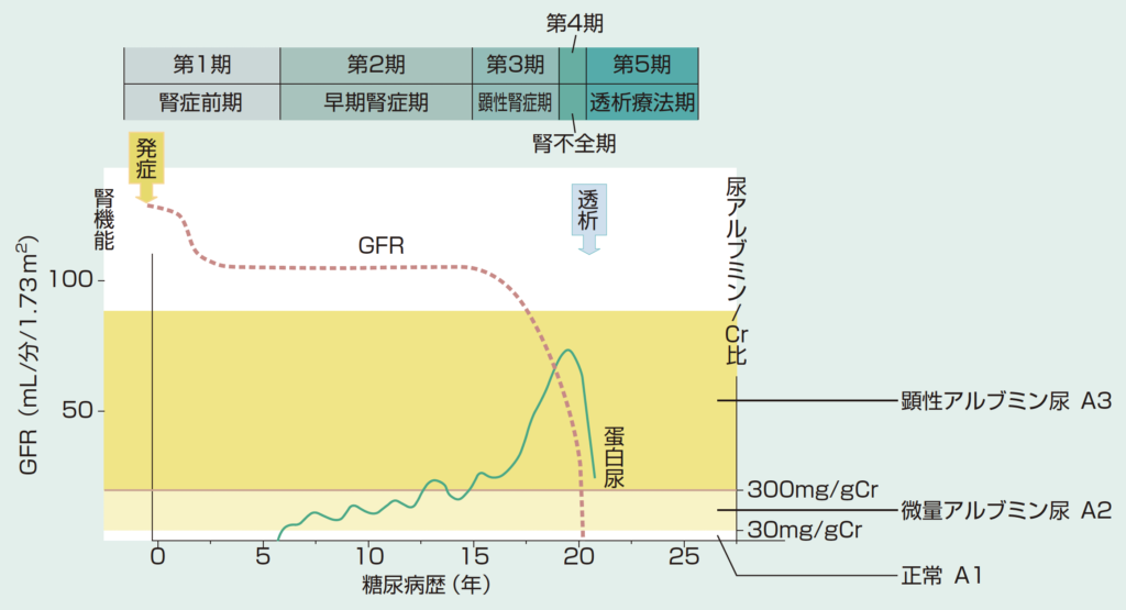 糖尿病網膜症はどのように診断されますか?